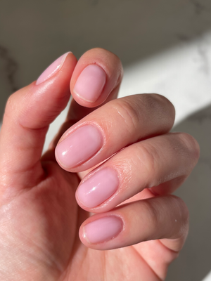 What is your approach to treating these yellow fingernails? | Consultant360
